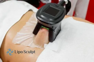 Are The Results From Aqualyx Permanent? 4 Compare Aqualyx Avonmouth to other fat reduction treatments.