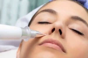 Best Actinic Keratoses Removal 3 Actinic keratoses Avonmouth solutions - book in today!